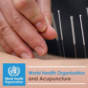 World Health Organization and Acupunture