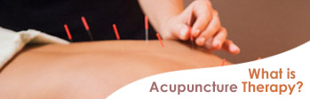 what is acupunture theraphy