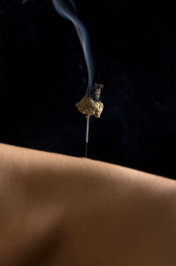 boosting immunity with moxibustion for self-treatment